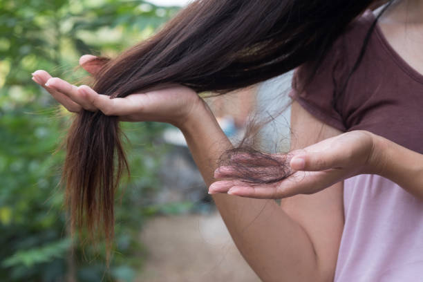 ayurvedic treatment for hair loss